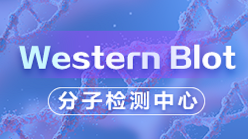 Western Blot 检测（理论篇）