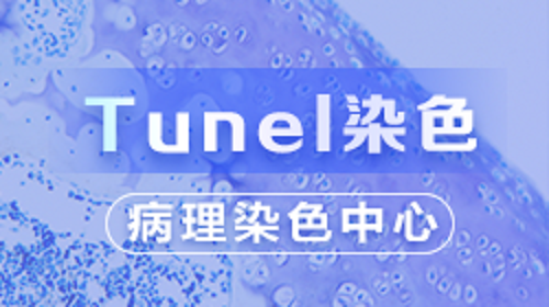 tunel细胞凋亡（理论篇）