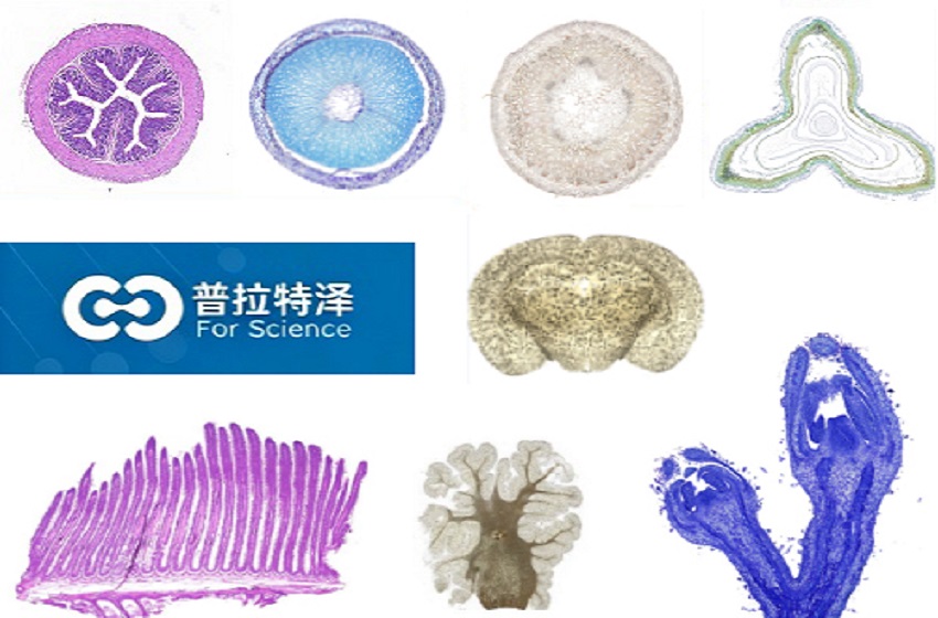 尼氏染色-1