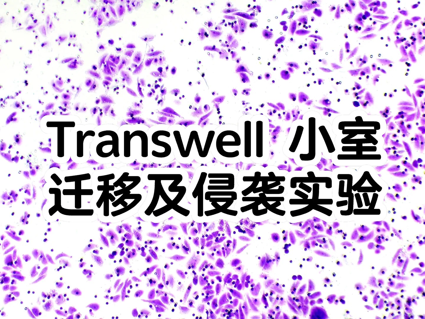 Transwell迁移/侵袭实验：原理、区别、选型