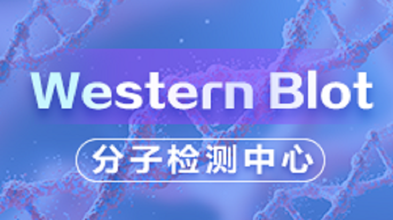 Western Blot 检测（实操篇）