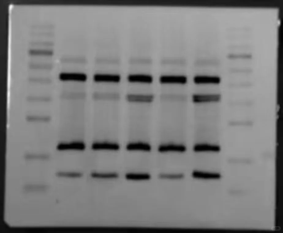 Western blot （WB）条带灰度值测量一文就会