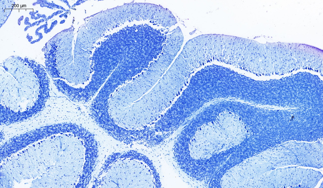 神经研究入门必学｜尼氏染色 Nissl Staining 超全解读🧠
