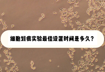 细胞划痕实验最佳设置时间是多久？