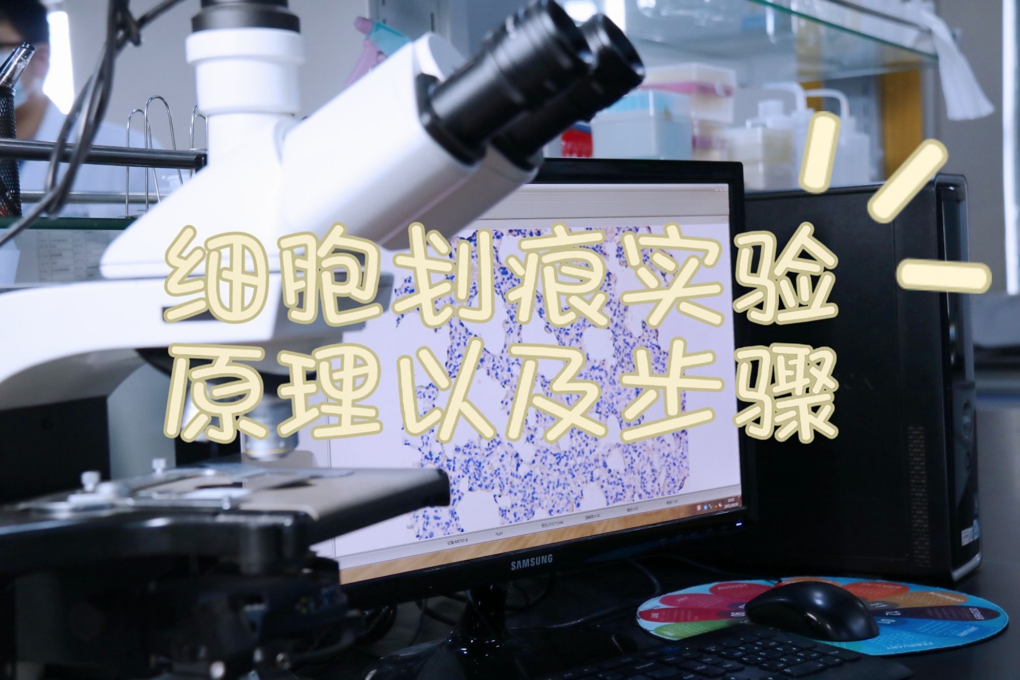 细胞划痕实验原理以及步骤