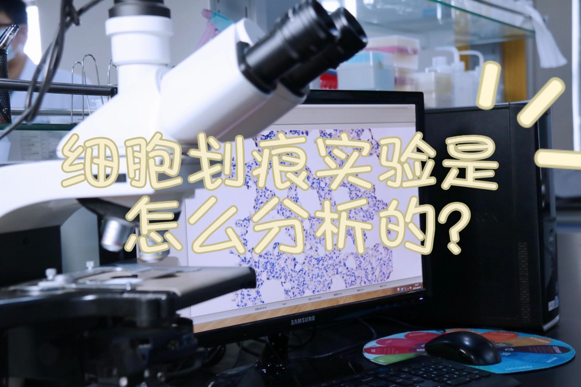 细胞划痕实验是怎么分析的？