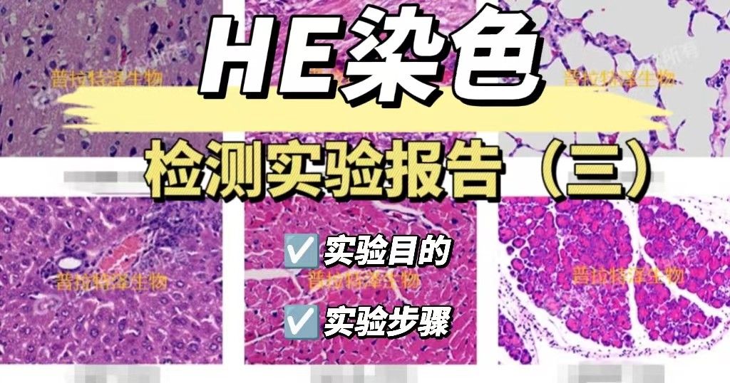 HE检测实验报告（三）