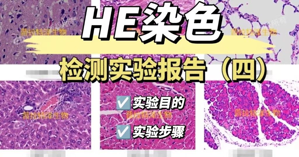 HE检测实验报告（四）