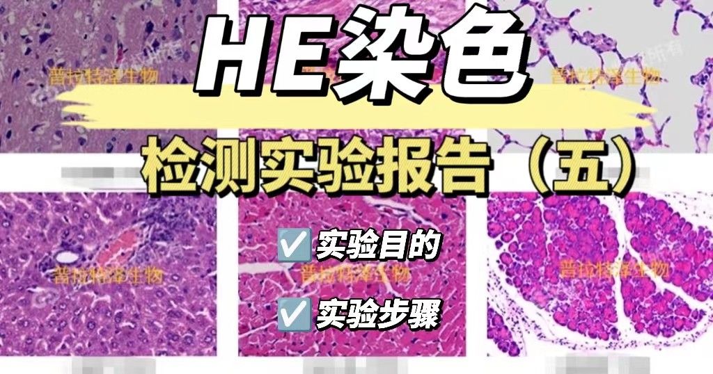 HE检测实验报告（五）