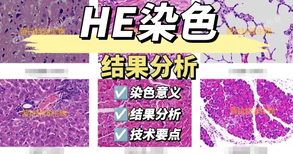 HE染色结果分析【HE染色实验】