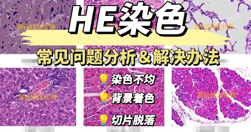 HE染色常见问题分析和解决方法【汇总】