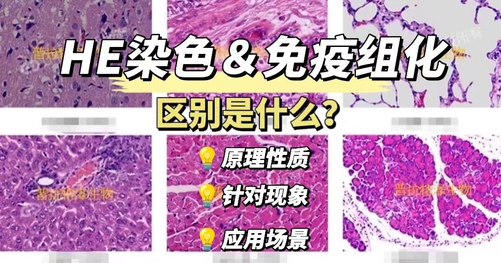HE染色和免疫组化的区别是什么？