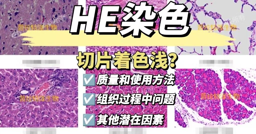 为什么HE染色切片着色浅？