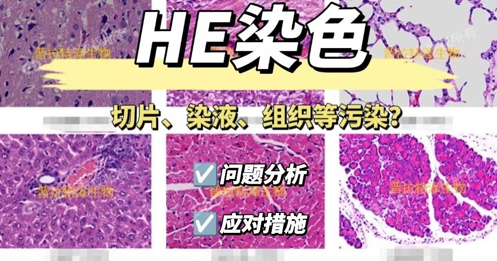 he染色中出现切片或染液、组织及盖载玻片的污染怎么办？