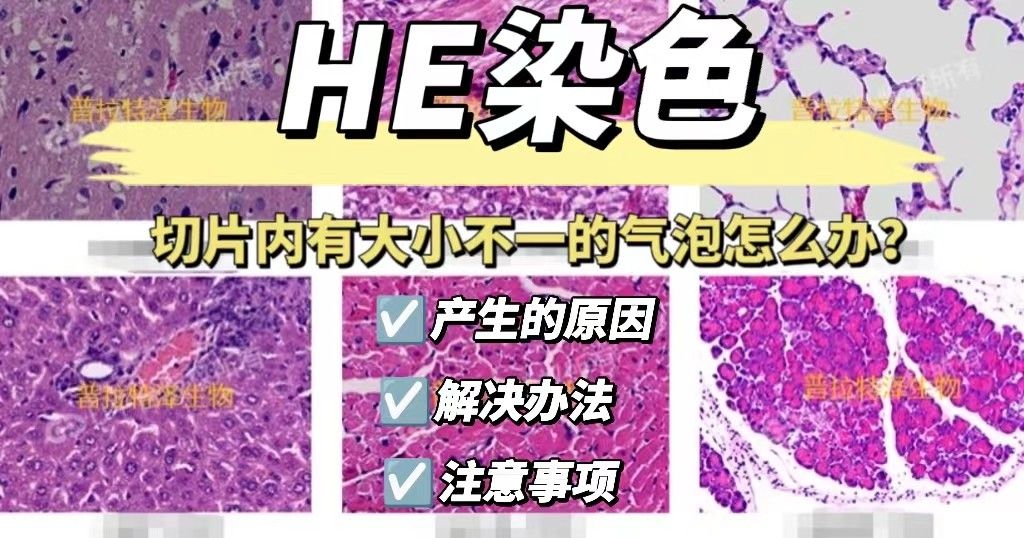HE染色过程中切片内有大小不一的气泡怎么办