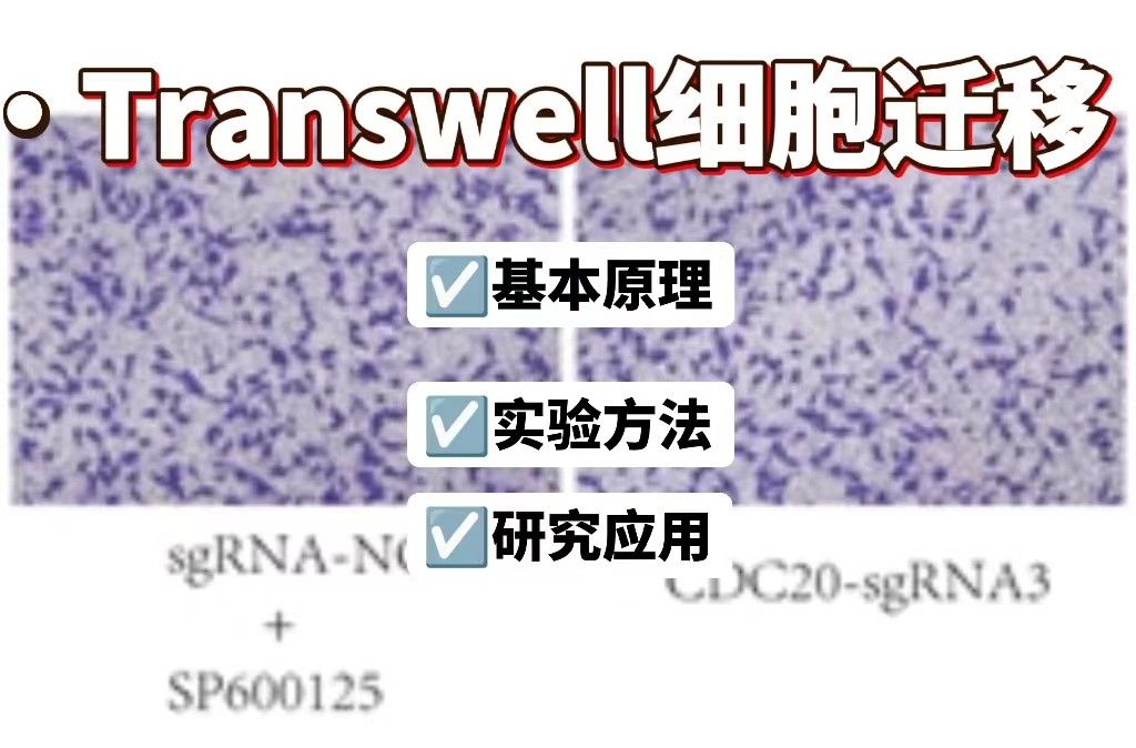 Transwell细胞迁移