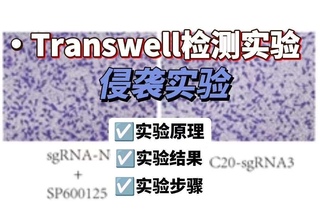 Transwell侵袭实验报告【新人必看】
