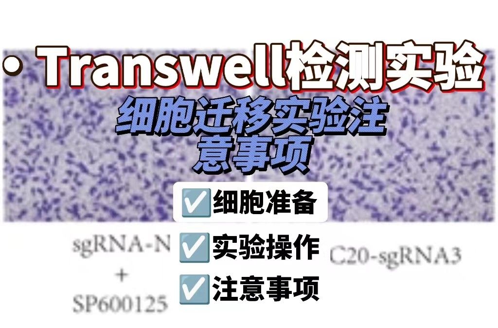 Transwell细胞迁移实验注意事项