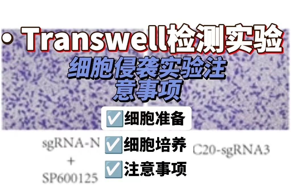 Transwell侵袭注意事项