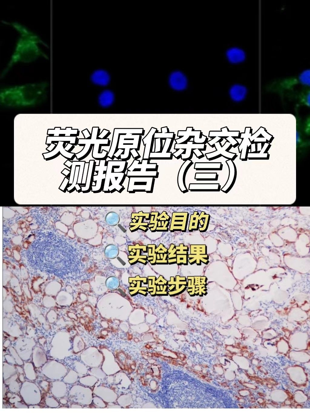 荧光原位杂交检测实验报告（三）