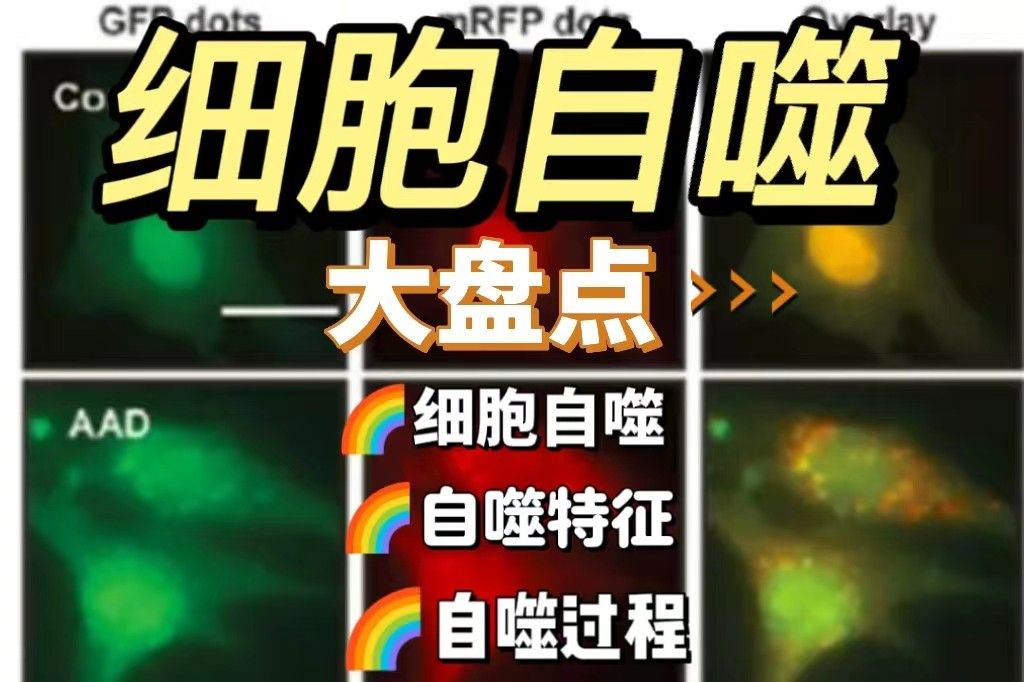 细胞自噬大盘点 