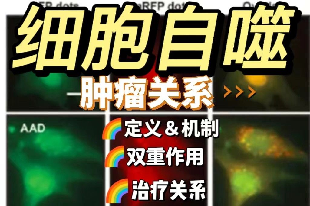 细胞自噬与肿瘤的关系