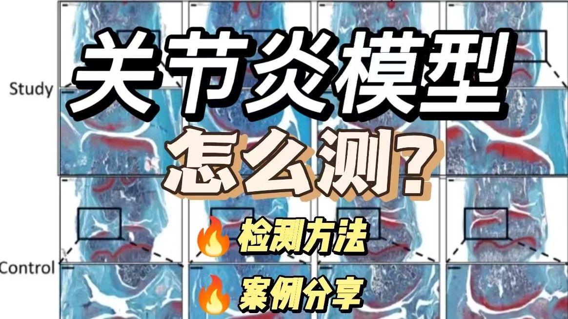 关节炎模型怎么测？关节炎模型检测方法全解析