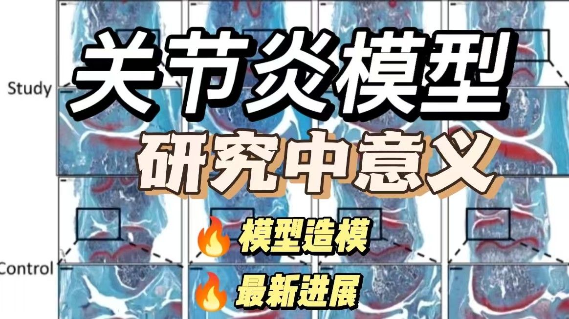 关节炎模型造模在疾病研究中的意义