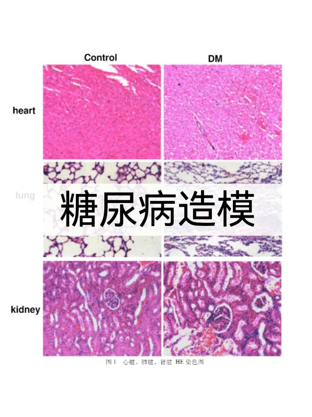 糖尿病模型小鼠模型注意事项