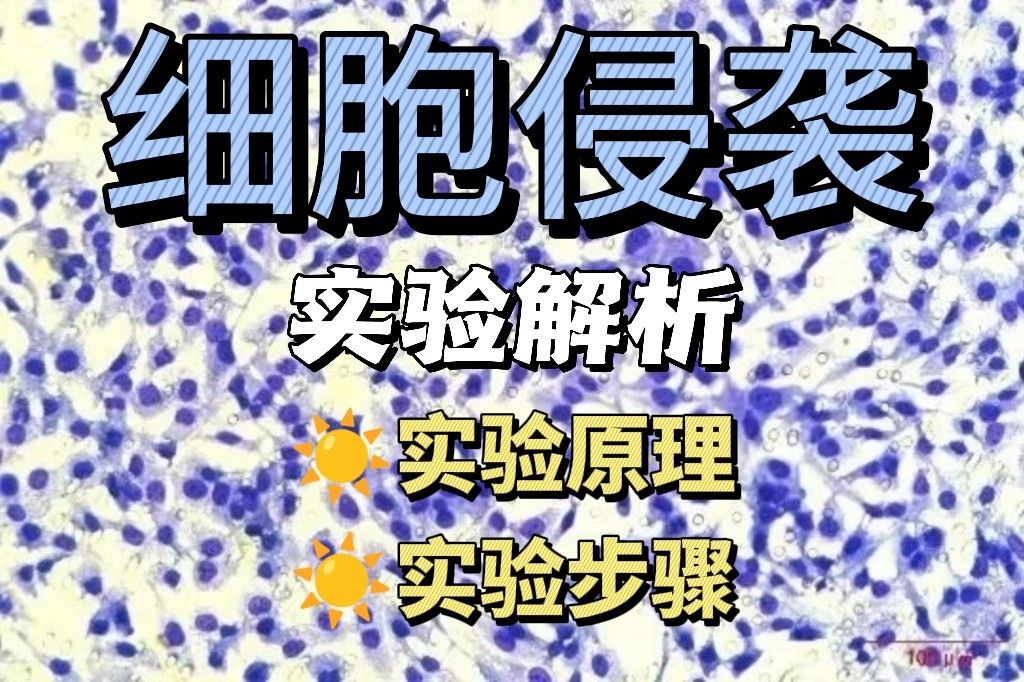 细胞侵袭检测技术及Transwell实验全解析