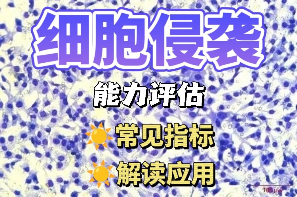 细胞侵袭能力评估指标有哪些？迁移速度、穿透率等数据解读
