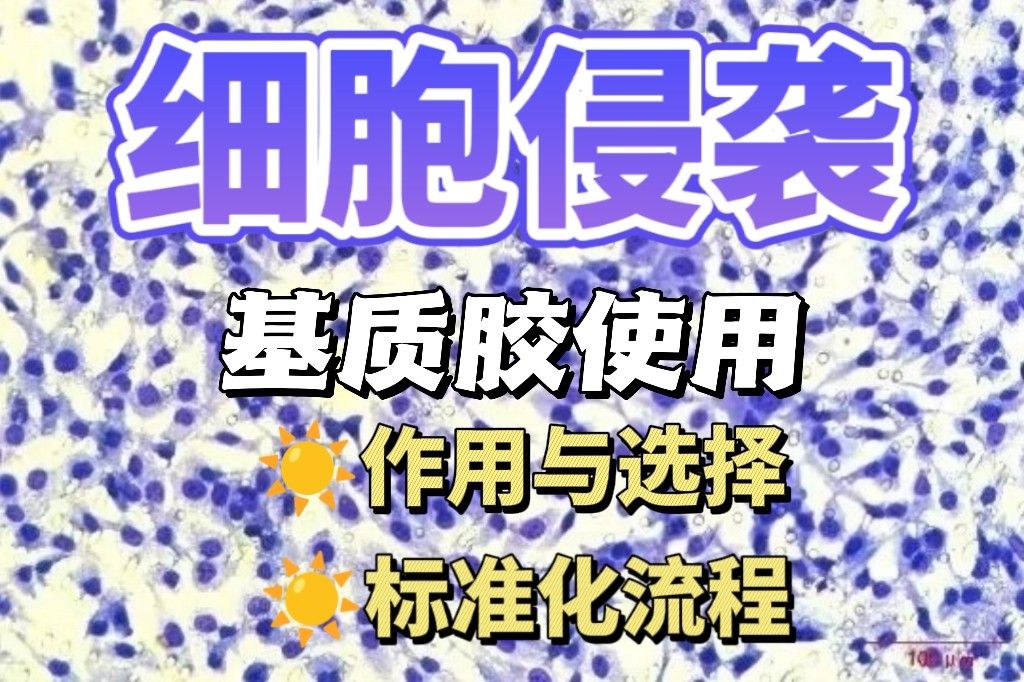 细胞侵袭实验基质胶使用全指南：浓度选择、铺板技巧与常见问题解析