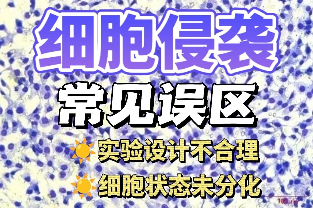 细胞侵袭实验总是失败？这 5 个常见误区你避开了吗？