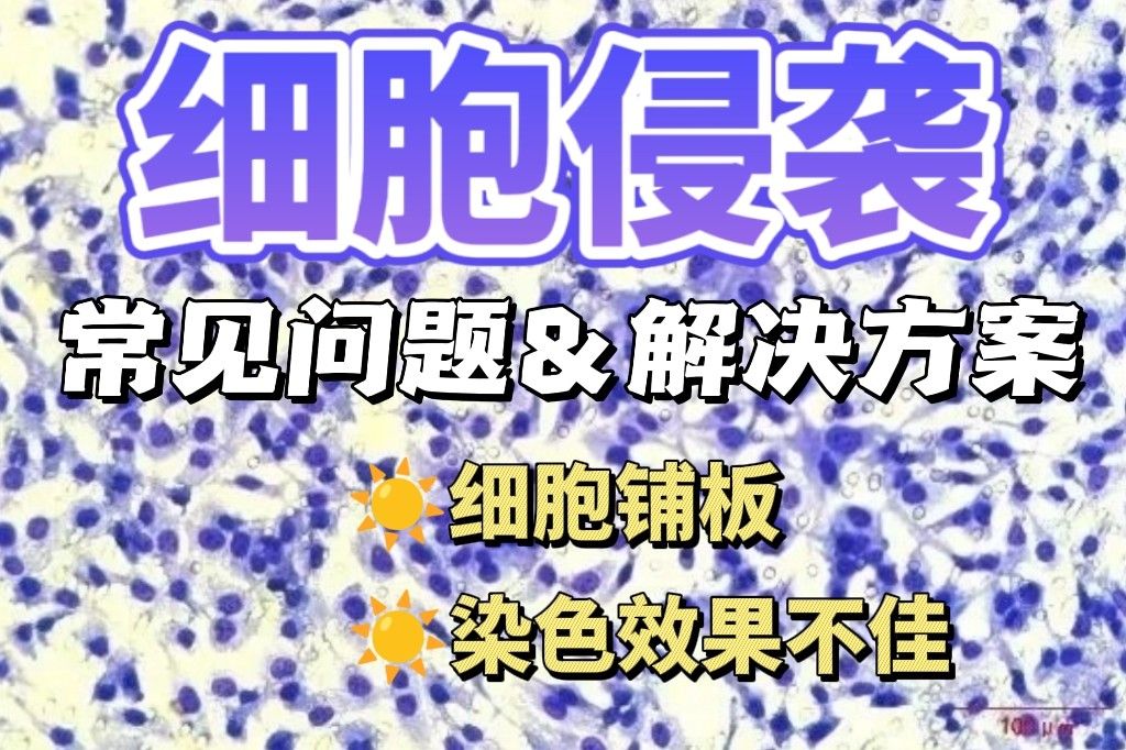 细胞侵袭实验常见问题与解决方案，一文掌握关键要点