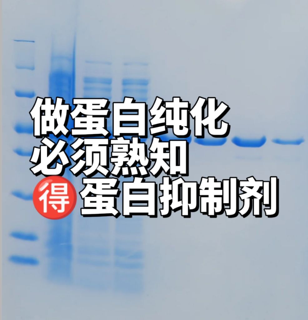 做蛋白纯化，必须要熟知的一些蛋白酶抑制剂