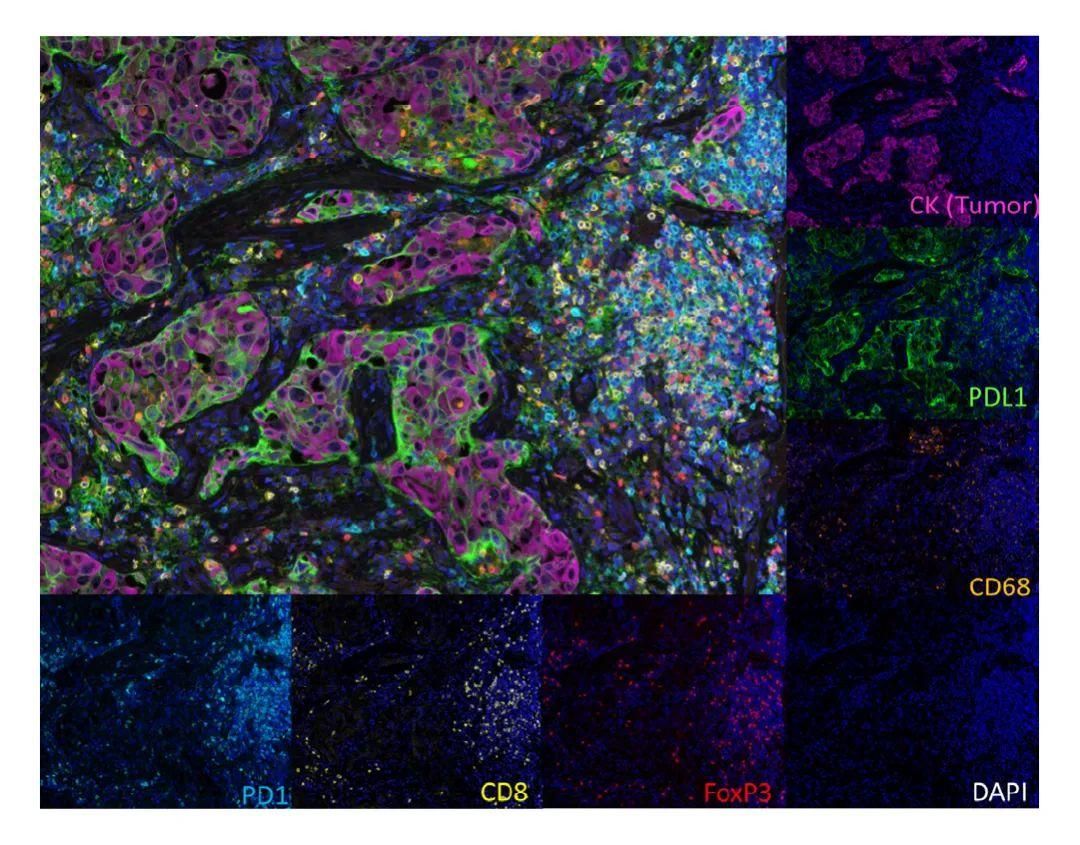 多色免疫荧光（TSA）和免疫组化、免疫荧光（IHC/IF）的区别