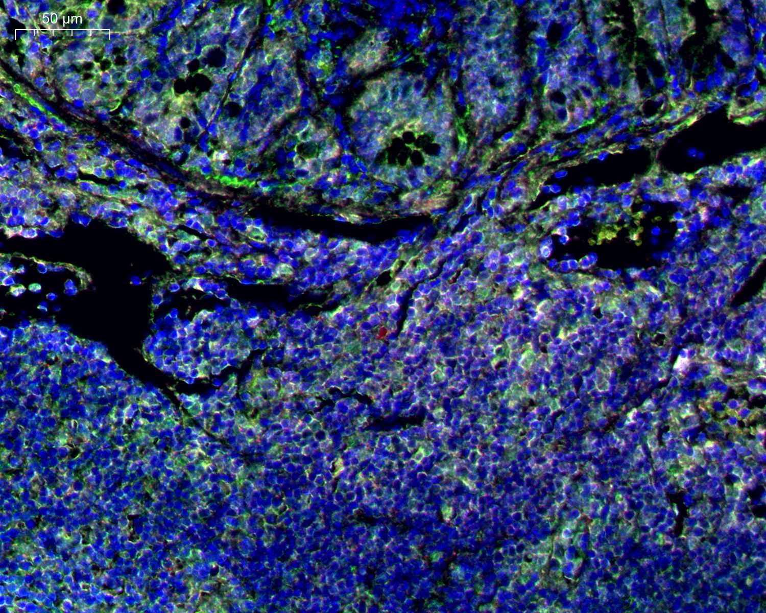 TSA多色荧光顺序定成败！科学染色流程设计指南~