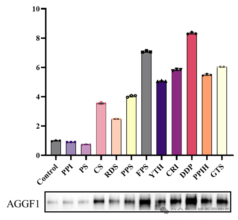 Image J处理WB蛋白条带并用Graphpad美图全